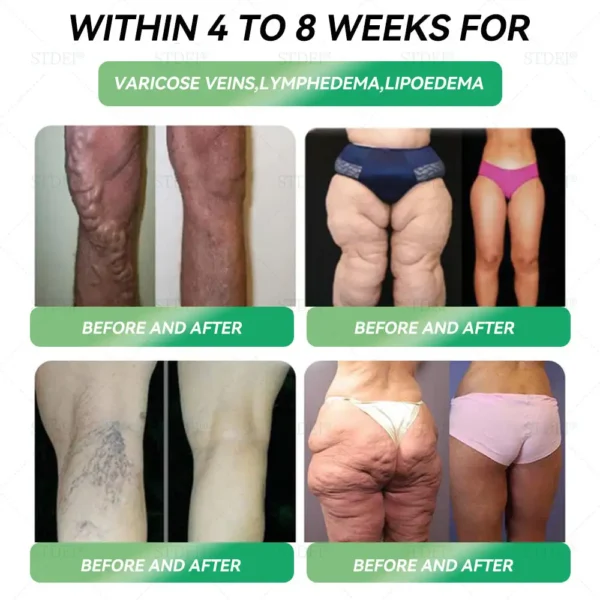 Cvreōz® GLP-1 Weight Loss Oral Solution