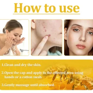 🌟 Official Store | Cvreoz® Bee Venom Skin Treatment Cream🚀LAST DAY 80% OFF(Sagging Skin, Fine Lines, Loss of Firmness, Flat Bust, Drooping Hips, and More) (Copy)