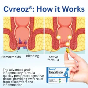 Cvreoz® 𝐍𝐚𝐭𝐮𝐫𝐚𝐥 𝐇𝐞𝐫𝐛𝐬 𝐒𝐭𝐫𝐞𝐧𝐠𝐭𝐡 𝐇𝐞𝐦𝐨𝐫𝐫𝐡𝐨𝐢𝐝𝐬 𝐂𝐚𝐩𝐬𝐮𝐥𝐞𝐬