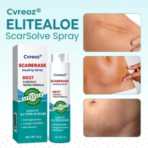 ⏰ Last Day Promotion 60% OFF 🔥 Cvreoz® EliteAloe ScarSolve Spray