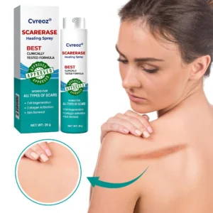 ⏰ Last Day Promotion 60% OFF 🔥 Cvreoz® EliteAloe ScarSolve Spray