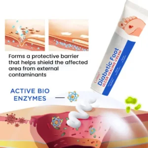 Cvreoz® Diabetic Foot Ulcer Healing Cream (𝟟𝟘% 𝕆𝔽𝔽 𝗘𝗡𝗗𝗦 𝗜𝗡 𝟭𝟬 𝗠𝗜𝗡𝗨𝗧𝗘𝗦)