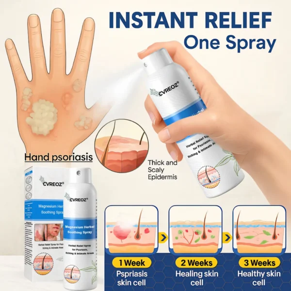 Cvreoz® Magnesium Herbal Psoriasis Spray 👨‍⚕️ FDA Approved