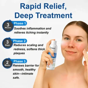 Cvreoz® Magnesium Herbal Psoriasis Spray 👨‍⚕️ FDA Approved