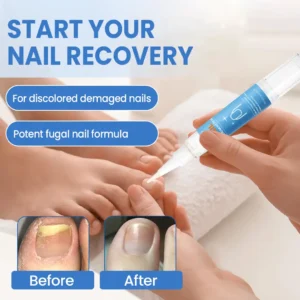 Cvreoz® MycoErase Nail Revive Pen