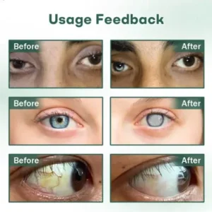 Cvreoz® Nano Eye Drops Serum Pro