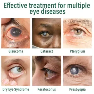 Cvreoz® Nano Eye Drops Serum Pro✅FDA Approved(Suitable for presbyopia, dry eye syndrome, glaucoma, and cataracts)