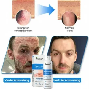 Cvreoz® Neuro-Calm Anti-Juckreiz Akut-Spray