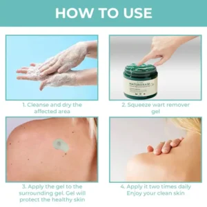 🔥FDA Approved⭐ WHO Approved🌍 Cvreoz® NatureErase Instant Mole & Spot Removal Gel - Deep Penetrated✅ All Natural Ingredients🌿
