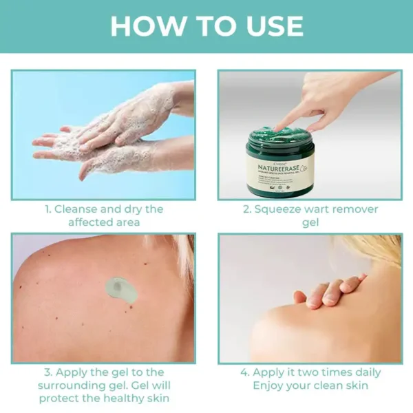 🔥FDA Approved⭐ WHO Approved🌍 Cvreoz® NatureErase Instant Mole & Spot Removal Gel - Deep Penetrated✅ All Natural Ingredients🌿