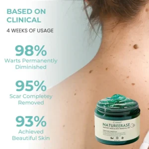🔥FDA Approved⭐ WHO Approved🌍 Cvreoz® NatureErase Instant Mole & Spot Removal Gel - Deep Penetrated✅ All Natural Ingredients🌿