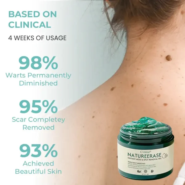🔥FDA Approved⭐ WHO Approved🌍 Cvreoz® NatureErase Instant Mole & Spot Removal Gel - Deep Penetrated✅ All Natural Ingredients🌿