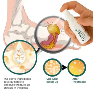 CVREOZ GoutEase Relief Spray