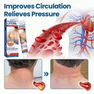 Cvreoz® BumpClear Lipoma Removal Cream