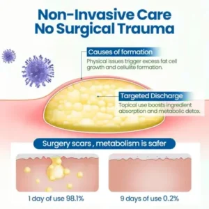 Cvreoz® BumpClear Lipoma Removal Cream