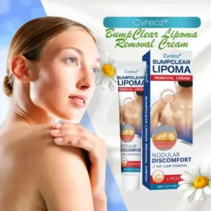 Cvreoz® BumpClear Lipoma Removal Cream