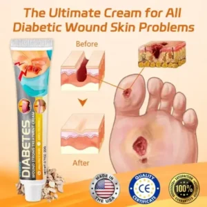 Cvreoz® Diabetes Wound Strong Treatment Cream