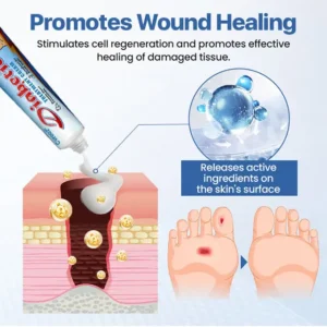 Cvreoz® VitaGluco Diabetes Treatment Cream✅ Heal Diabetic Wounds Faster & Safer