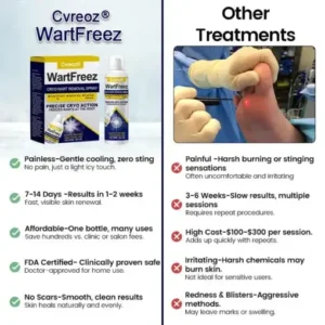 Cvreoz® WartFreez Cryo Wart Removal Spray