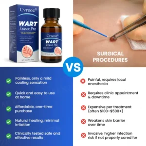 🔥Warts No More - 50% OFF | Cvreoz® Wart Eraser Pro