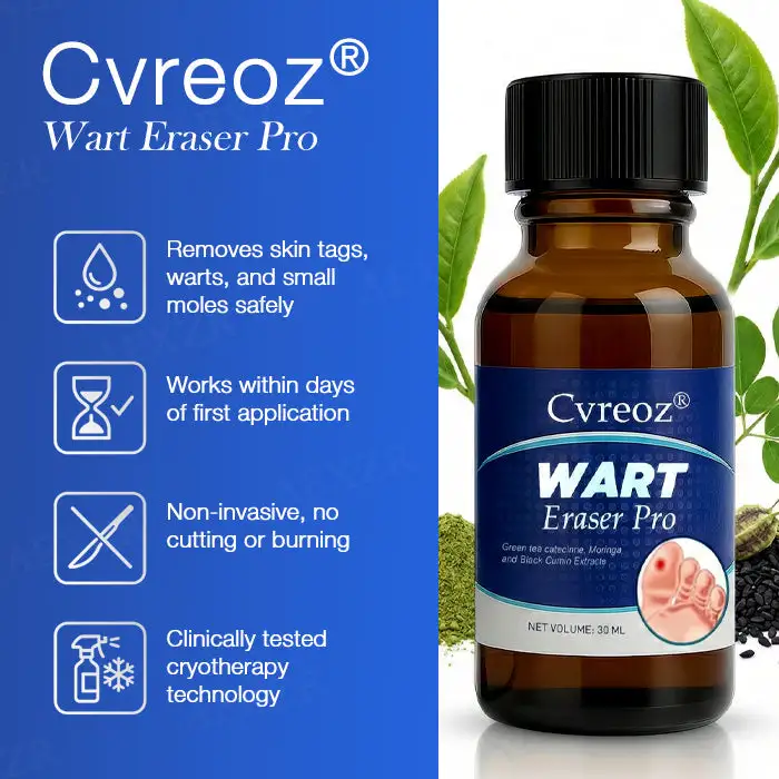 🔥Warts No More - 50% OFF | Cvreoz® Wart Eraser Pro