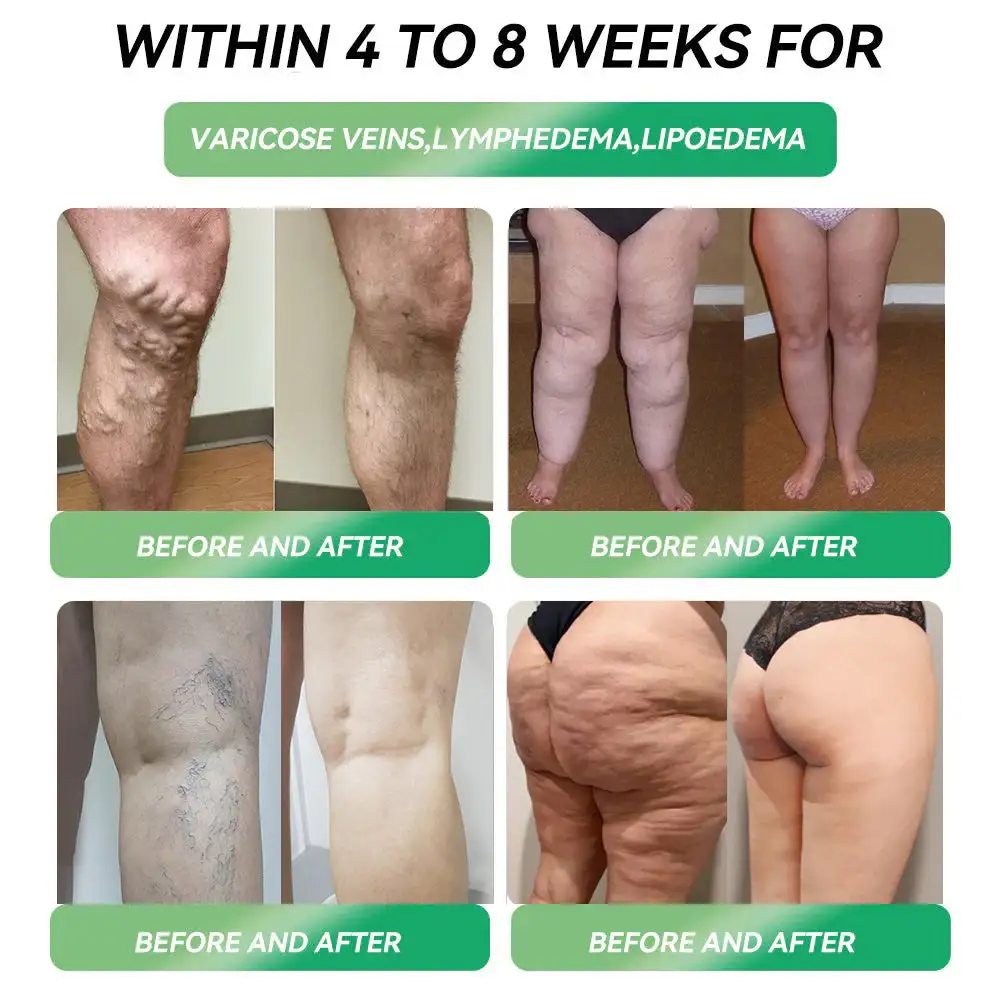 🎄 Christmas Sale: Buy 5 Get 5 Free | Cvreoz® 6-in-1 Metabolism & Vitality Drops | Results in 7 Days ⚡