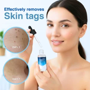 🏷️ EXCLUSIVE DEAL! 50% OFF - Cvreoz® Advanced Skin Tag & Wart Removal Essence