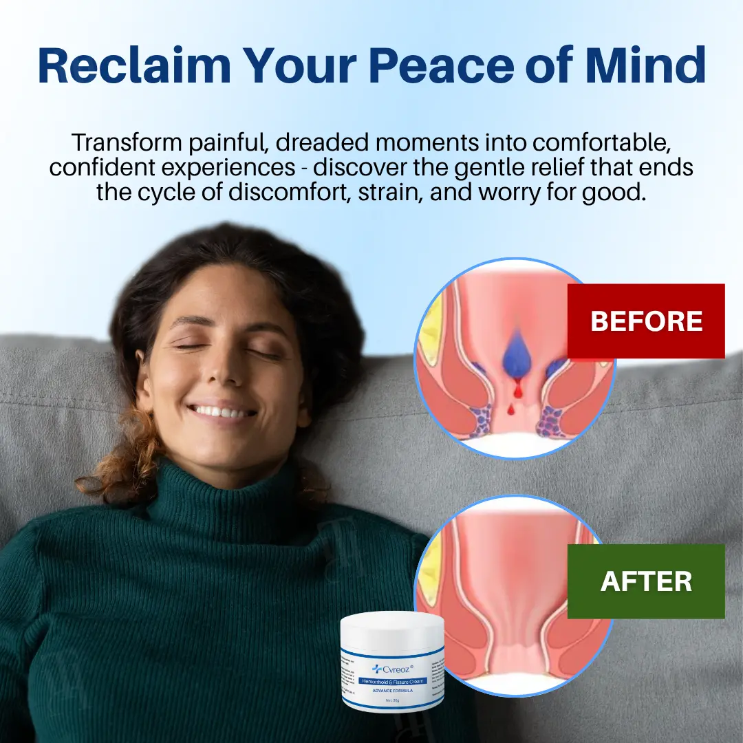 🏷️ EXCLUSIVE DEAL! 50% OFF - Cvreoz® Hemorrhoid & Fissure Cream