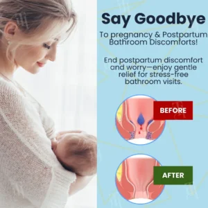 🏷️ EXCLUSIVE DEAL! 50% OFF - Cvreoz® Herbal Hemorrhoid Treatment Anal Spray + Wipes