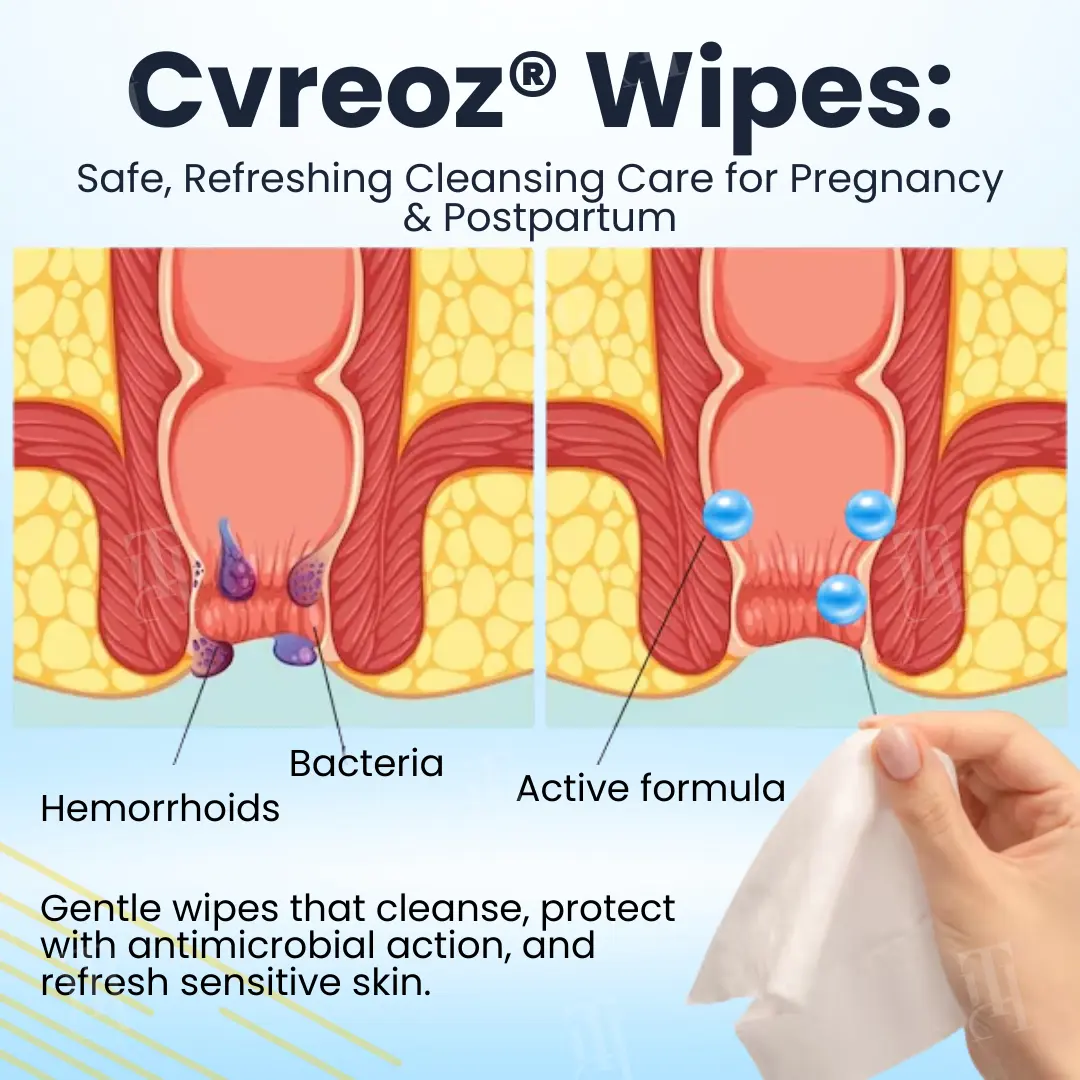 🏷️ EXCLUSIVE DEAL! 50% OFF - Cvreoz® Herbal Hemorrhoid Treatment Anal Spray + Wipes