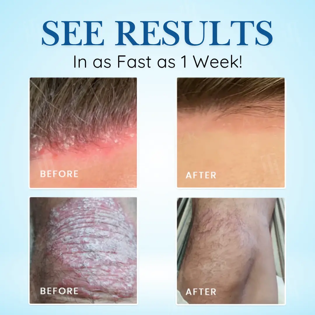 🏷️ EXCLUSIVE DEAL! 64% OFF - Cvreoz® Source-Relief Magnesium Spray (Copy)