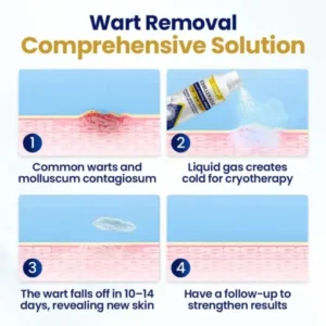 Cvreoz® ChillErase Bump Renewal Spray