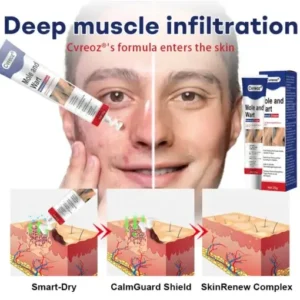 Cvreoz® Mole and Wart Removal Cream