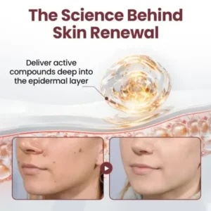 Cvreoz® OryzaClear Black Rice Botanical Keratin-Softening Cream